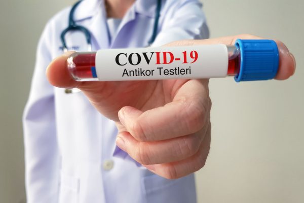 Covid-19 Antikor Testi Anlaşması
